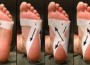 Taping-Techique Sparrc