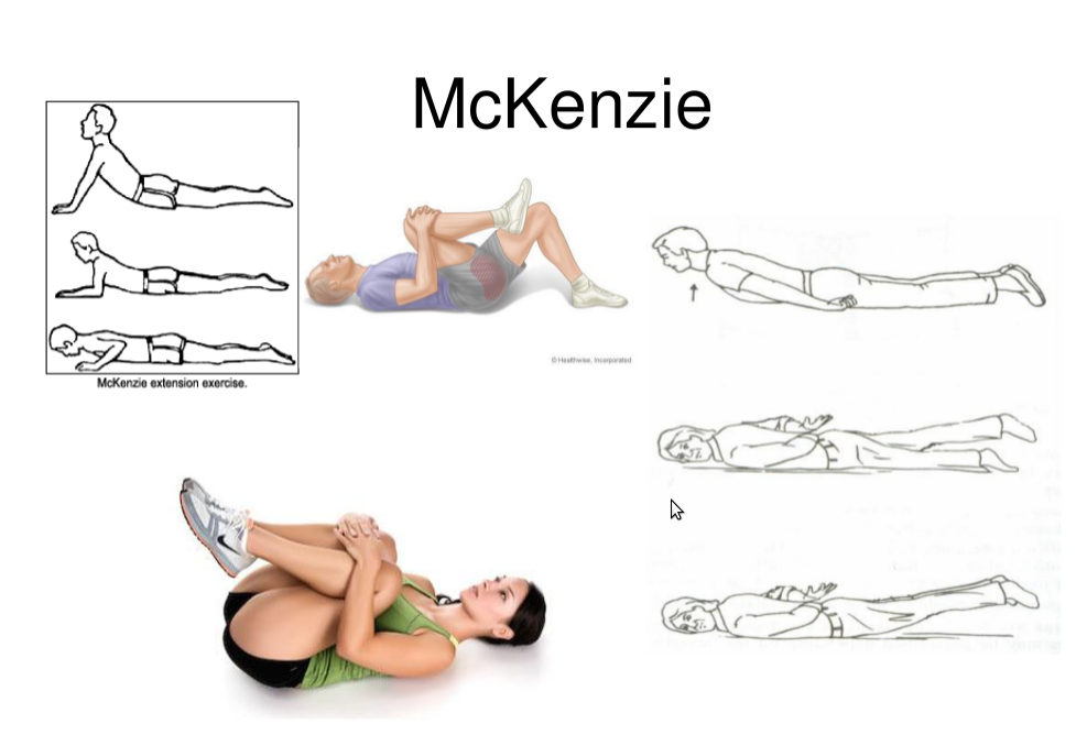 Image Result For Mckenzie Method Herniated Disc Image Result For Mckenzie Method Herniated Disc
